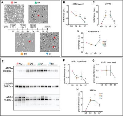 Heterogeneous nuclear ribonucleoprotein hnRNPA2/B1 regulates the abundance of the copper-transporter ATP7A in an isoform-dependent manner